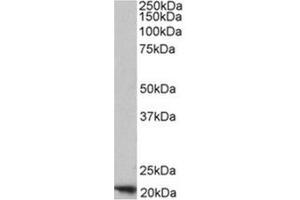 Image no. 1 for anti-Ferritin, Heavy Polypeptide 1 (FTH1) (C-Term), (Heavy Chain) antibody (ABIN375067) (FTH1 antibody  (C-Term, Heavy Chain))