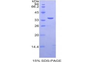 SDS-PAGE analysis of Human PST Protein. (SULT1A1 Protein)