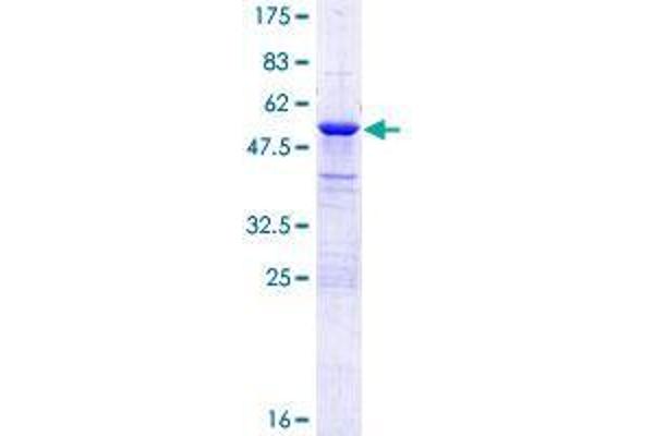 APIP Protein (AA 1-242) (GST tag)