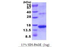 SDS-PAGE (SDS) image for Inhibin, beta A (INHBA) (AA 311-426) protein (His tag) (ABIN5854095)