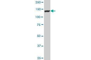 FLJ39155 polyclonal antibody (A01), Lot # 051024JC01 Western Blot analysis of FLJ39155 expression in NIH/3T3 . (EGFLAM antibody  (AA 914-1001))
