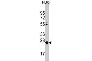 Western blot analysis of LIN28B polyclonal antibody  in HL-60 cell line lysates (35 ug/lane). (LIN28B antibody  (C-Term))