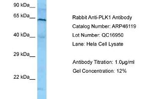 Western Blotting (WB) image for anti-Polo-Like Kinase 1 (PLK1) (N-Term) antibody (ABIN2782495) (PLK1 antibody  (N-Term))