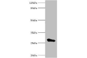 Western blot All lanes: MED6 antibody at 8 μg/mL + Jurkat whole cell lysate Secondary Goat polyclonal to rabbit IgG at 1/10000 dilution Predicted band size: 29, 30, 21 kDa Observed band size: 29 kDa (MED6 antibody  (AA 27-246))