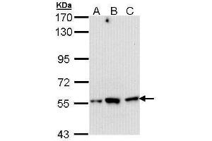WB Image Sample (30 ug of whole cell lysate) A: Hep G2 , B: Molt-4 , C: Raji 7. (DARS antibody)