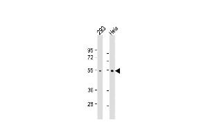 All lanes : Anti- at 1:1000 dilution Lane 1: 293 whole cell lysate Lane 2: Hela whole cell lysate Lysates/proteins at 20 μg per lane. (TRAF2 antibody)