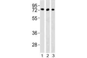 Western blot testing of TFE3 antibody and 1) HepG2, 293 and 3) mouse lung lysate (TFE3 antibody  (AA 1-30))