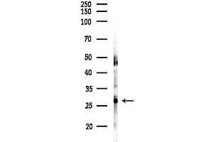 Western blot analysis of lysates from Mouse brain, using STMN4 Antibody at 1/1000 dilution.