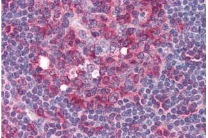 Human Tonsil (formalin-fixed, paraffin-embedded) stained with Tubulin, Alpha 1 (TUBA1) antibody ABIN364374 at 5 ug/ml followed by biotinylated anti-mouse IgG secondary antibody ABIN481714, alkaline phosphatase-streptavidin and chromogen. (alpha Tubulin antibody  (N-Term))