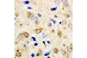 Immunohistochemical analysis of NPY5R staining in human brain formalin fixed paraffin embedded tissue section. (NPY5R antibody)