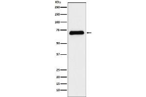 Western blot analysis of Serotonin transporter expression in Human fetal liver lysate.