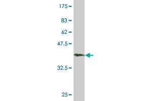 Western Blotting (WB) image for anti-Senataxin (SETX) (AA 2579-2676) antibody (ABIN565001)