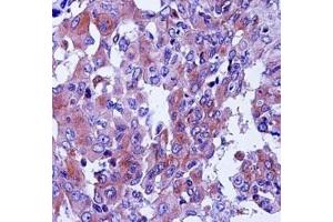 Immunohistochemistry (IHC) image for anti-Complement Decay-Accelerating Factor (CD55) (AA 51-79) antibody (ABIN3030560)
