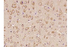 Paraformaldehyde-fixed, paraffin embedded rat brain, Antigen retrieval by boiling in sodium citrate buffer (pH6. (RNF170 antibody)