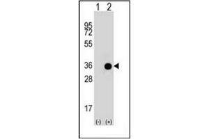 Western blot analysis of GNAO1 (arrow) using GNAO1 Antibody (C-term) Cat. (G Protein alpha 0 (AA 299-328), (C-Term) antibody)