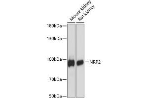 Western blot analysis of extracts of various cell lines, using NRP2 antibody (ABIN6128378, ABIN6144863, ABIN6144864 and ABIN6216499) at 1:3000 dilution. (NRP2 antibody  (AA 443-740))