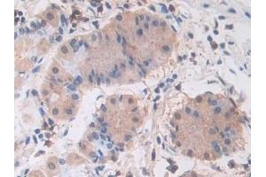 Immunohistochemistry (IHC) image for anti-Phosphoinositide-3-Kinase, Catalytic, beta Polypeptide (PIK3CB) (AA 807-1070) antibody (ABIN7437749)