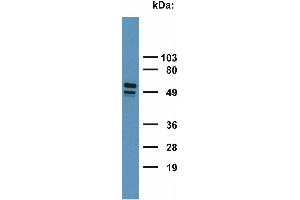Detection of Cytokeratin 7+17 in HeLa cell lysate with monoclonal antibody. (Keratin 7/17 antibody)