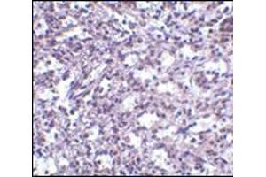 Immunohistochemistry of STIM2 in human spleen tissue with this product at 2. (Stim2 antibody  (C-Term))