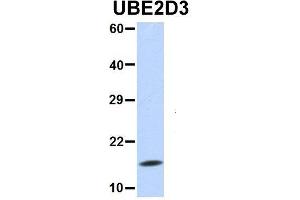 Western Blotting (WB) image for anti-Ubiquitin-Conjugating Enzyme E2D 3 (UBE2D3) (N-Term) antibody (ABIN2775674)