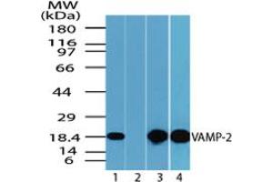 Image no. 1 for anti-Vesicle-Associated Membrane Protein 2 (Synaptobrevin 2) (VAMP2) (AA 1-50) antibody (ABIN960402) (VAMP2 antibody  (AA 1-50))