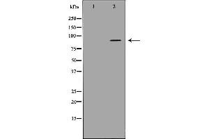 Western blot analysis of extracts of hela cell line, using ADAMTS4 antibody,the lane on the left is blocked by antigen peptide.