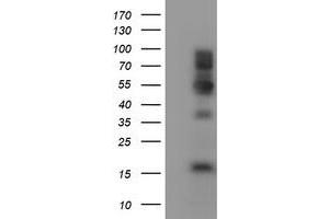 Western Blotting (WB) image for anti-Fragile X Mental Retardation 1 (FMR1) (AA 36-279) antibody (ABIN1491456) (FMR1 antibody  (AA 36-279))