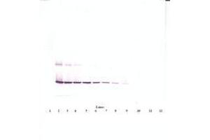 Image no. 2 for anti-Ciliary Neurotrophic Factor (CNTF) antibody (ABIN1497554) (CNTF antibody)
