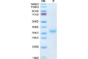 Mouse Adiponectin/Acrp30 on Tris-Bis PAGE under reduced condition. (ADIPOQ Protein (AA 18-247) (His tag))
