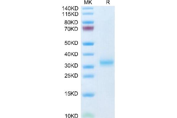 ADIPOQ Protein (AA 18-247) (His tag)