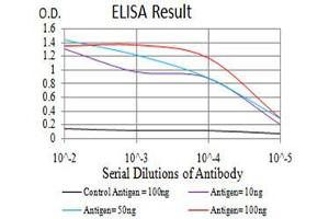 Black line: Control Antigen (100 ng), Purple line: Antigen(10 ng), Blue line: Antigen (50 ng), Red line: Antigen (100 ng), (SIRT4 antibody  (AA 215-314))