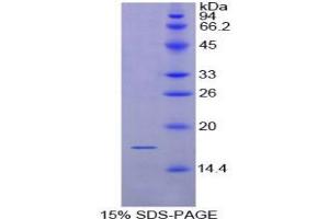 SDS-PAGE analysis of Rat CD72 Protein. (CD72 Protein)