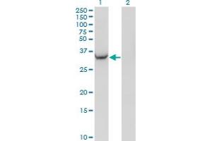 Western Blot analysis of AKR1C2 expression in transfected 293T cell line by AKR1C2 monoclonal antibody (M03A), clone 3C11. (AKR1C2 antibody  (AA 224-323))