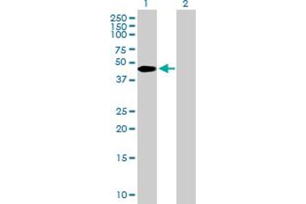 ZBTB37 antibody  (AA 1-361)