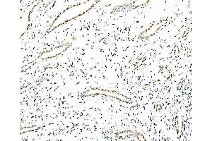 IHC analysis of splicing factor 1 using anti-splicing factor 1 antibody (ABIN7600194). (Splicing Factor 1 antibody  (AA 160-266))