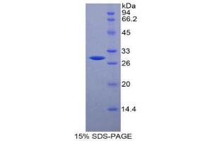 SDS-PAGE (SDS) image for Chitinase 3-Like 1 (Cartilage Glycoprotein-39) (CHI3L1) (AA 112-356) protein (His tag) (ABIN1879791) (CHI3L1 Protein (AA 112-356) (His tag))