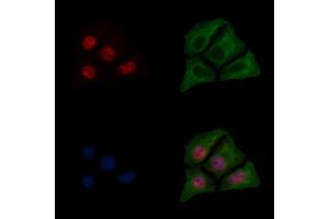 ABIN6255153 and ABIN6267596 staining HepG2 cells(30 min of 4uM Forskolin treatment) by IF/ICC. (NF-kB p65 antibody  (pSer276))