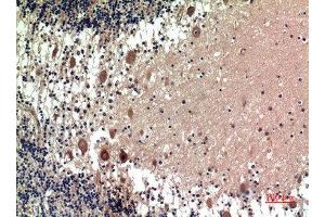 Immunohistochemical analysis of paraffin-embedded human-brain, antibody was diluted at 1:100 (5HT1D antibody  (Internal Region))