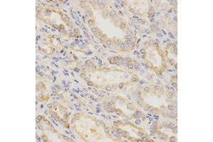 Immunohistochemistry of paraffin-embedded human kidney using GGA2 Antibody. (GGA2 antibody  (AA 1-300))