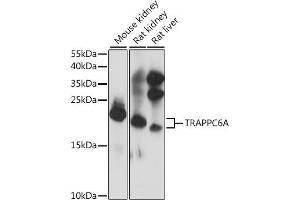 Western blot analysis of extracts of various cell lines, using TRA antibody (ABIN7270871) at 1:1000 dilution. (TRAPPC6A antibody  (AA 1-173))