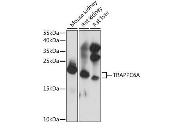 TRAPPC6A 抗体  (AA 1-173)