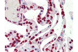 Immunohistochemistry of Histone H3 antibody Tissue: Lung Fixation: formalin fixed paraffin embedded Antigen retrieval: user optimized Primary antibody:  Histone H3 antibody 1:100 Secondary antibody: Peroxidase goat anti-rabbit at 1:10,000 for 45 min at RT Image provided courtesy of Andrew Elston, LifeSpan BioSciences, Inc. (Histone 3 antibody  (C-Term))