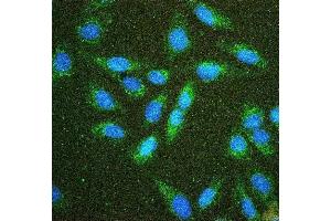 IF analysis of Hexokinase 1/HK1 using anti-Hexokinase 1/HK1 antibody (ABIN7600260). (Hexokinase 1 antibody  (AA 17-323))