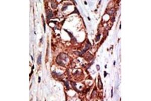 Image no. 1 for anti-SUMO1 Activating Enzyme Subunit 1 (SAE1) (C-Term) antibody (ABIN357744) (SAE1 antibody  (C-Term))