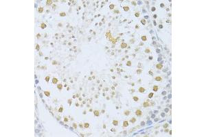 Immunohistochemistry of paraffin-embedded mouse testis using POLR2A antibody (ABIN5998562) at dilution of 1/100 (40x lens). (POLR2A/RPB1 antibody)