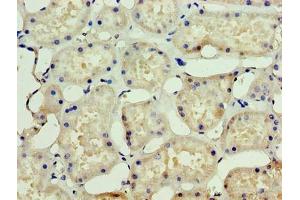 Immunohistochemistry of paraffin-embedded human kidney tissue using ABIN7169765 at dilution of 1:100 (SSSCA1 antibody  (AA 2-199))