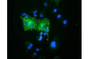 Immunofluorescence (IF) image for anti-Oxysterol Binding Protein-Like 11 (OSBPL11) antibody (ABIN1499921)