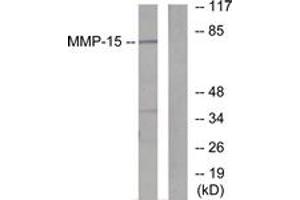 Western blot analysis of extracts from MDA-MB-435 cells, using MMP-15 Antibody. (MMP15 antibody  (AA 611-660))