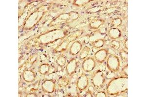 Immunohistochemistry of paraffin-embedded human kidney tissue using ABIN7154947 at dilution of 1:100 (CD34 antibody  (AA 124-375))