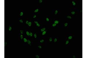 Immunofluorescence staining of Hela cells with ABIN7139626 at 1:25, counter-stained with DAPI. (Histone H1.3 antibody  (pThr179))